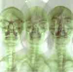 SUPERGRASS